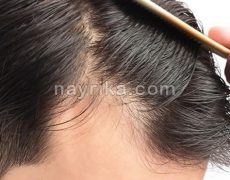 دعا برای درمان ریزش مو / روایات برای رویش مجدد مو، تقویت و پرپشت شدن مو دعا برای درمان ریزش مو / روایات برای رویش مجدد مو، تقویت و پرپشت شدن مو
