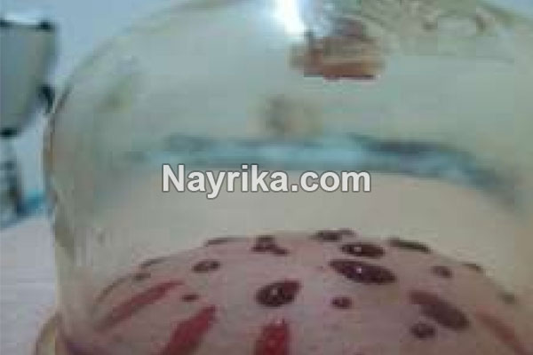 حجامت, حجامت چیست, روش حجامت, انواع حجامت, زمان حجامت, حجامت کبد, حجامت سر, خواص حجامت, عوارض حجامت, حجامت برای جوش صورت, حجامت برای لاغری, حجامت برای ریزش مو, حجامت برای کبد چرب, حجامت برای چاق شدن, حجامت برای لک صورت, حجامت فواید, عکس حجامت حجامت, حجامت چیست, روش حجامت, انواع حجامت, زمان حجامت, حجامت کبد, حجامت سر, خواص حجامت, عوارض حجامت, حجامت برای جوش صورت, حجامت برای لاغری, حجامت برای ریزش مو, حجامت برای کبد چرب, حجامت برای چاق شدن, حجامت برای لک صورت, حجامت فواید, عکس حجامت