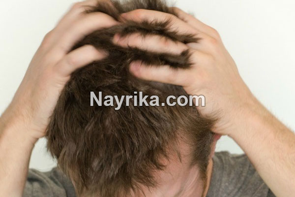 خارش سر, علت خارش سر در طب سنتی, علت خارش سر در کودکان, علت خارش سر بعد از شستشو, درمان گیاهی خارش پوست سر, درمان خارش سر با سرکه, شامپوی مناسب برای خارش سر, درمان خانگی خارش سر و ریزش مو, علت خارش سر در طب اسلامی خارش سر, علت خارش سر در طب سنتی, علت خارش سر در کودکان, علت خارش سر بعد از شستشو, درمان گیاهی خارش پوست سر, درمان خارش سر با سرکه, شامپوی مناسب برای خارش سر, درمان خانگی خارش سر و ریزش مو, علت خارش سر در طب اسلامی