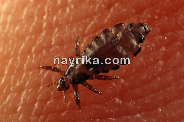 شپش, شپش چیست, طول عمر شپش سر, شپش بدن, دشمن شپش, درمان شپش با اسپند, درمان شپش با سرکه و نمک, درمان شپش با رنگ مو, درمان شپش با قران, درمان شپش سر با حنا, درمان شپش با پودر لباسشویی, درمان قطعی شپش با شامپو, درمان شپش سر با حنا, درمان شپش سر با سرکه, عکس شپش سر, شپش مکنده, شپش نر و ماده شپش, شپش چیست, طول عمر شپش سر, شپش بدن, دشمن شپش, درمان شپش با اسپند, درمان شپش با سرکه و نمک, درمان شپش با رنگ مو, درمان شپش با قران, درمان شپش سر با حنا, درمان شپش با پودر لباسشویی, درمان قطعی شپش با شامپو, درمان شپش سر با حنا, درمان شپش سر با سرکه, عکس شپش سر, شپش مکنده, شپش نر و ماده
