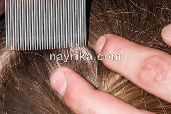 شپش, شپش چیست, طول عمر شپش سر, شپش بدن, دشمن شپش, درمان شپش با اسپند, درمان شپش با سرکه و نمک, درمان شپش با رنگ مو, درمان شپش با قران, درمان شپش سر با حنا, درمان شپش با پودر لباسشویی, درمان قطعی شپش با شامپو, درمان شپش سر با حنا, درمان شپش سر با سرکه, عکس شپش سر, شپش مکنده, شپش نر و ماده شپش, شپش چیست, طول عمر شپش سر, شپش بدن, دشمن شپش, درمان شپش با اسپند, درمان شپش با سرکه و نمک, درمان شپش با رنگ مو, درمان شپش با قران, درمان شپش سر با حنا, درمان شپش با پودر لباسشویی, درمان قطعی شپش با شامپو, درمان شپش سر با حنا, درمان شپش سر با سرکه, عکس شپش سر, شپش مکنده, شپش نر و ماده