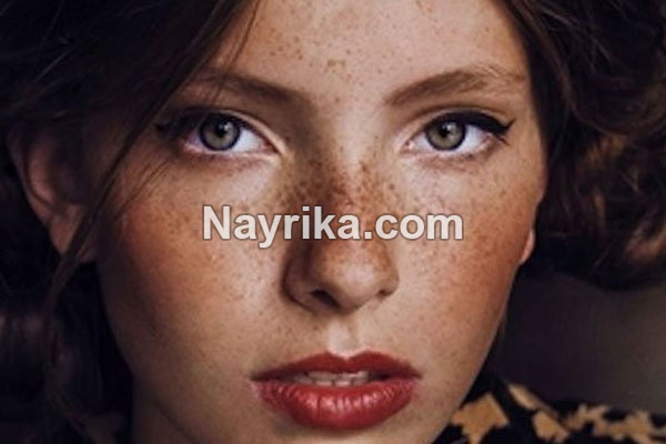 کک و مک, کک و مک چیست, علت ایجاد کک و مک, درمان کک و مک ارثی, بهترین کرم برای رفع کک و مک, آلوورا برای کک و مک, ماسک عسل و دارچین برای کک و مک, درمان کک و مک با لیزر, هزینه لیزر کک و مک صورت, چرا کک و مک میزنیم کک و مک, کک و مک چیست, علت ایجاد کک و مک, درمان کک و مک ارثی, بهترین کرم برای رفع کک و مک, آلوورا برای کک و مک, ماسک عسل و دارچین برای کک و مک, درمان کک و مک با لیزر, هزینه لیزر کک و مک صورت, چرا کک و مک میزنیم
