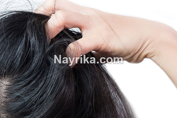 خارش سر, علت خارش سر در طب سنتی, علت خارش سر در کودکان, علت خارش سر بعد از شستشو, درمان گیاهی خارش پوست سر, درمان خارش سر با سرکه, شامپوی مناسب برای خارش سر, درمان خانگی خارش سر و ریزش مو, علت خارش سر در طب اسلامی خارش سر, علت خارش سر در طب سنتی, علت خارش سر در کودکان, علت خارش سر بعد از شستشو, درمان گیاهی خارش پوست سر, درمان خارش سر با سرکه, شامپوی مناسب برای خارش سر, درمان خانگی خارش سر و ریزش مو, علت خارش سر در طب اسلامی