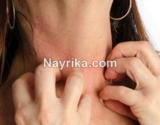 خارش بدن نشانه چیست / علت خارش بدن در شب / علت خارش دست و پا و کل بدن خارش بدن نشانه چیست / علت خارش بدن در شب / علت خارش دست و پا و کل بدن