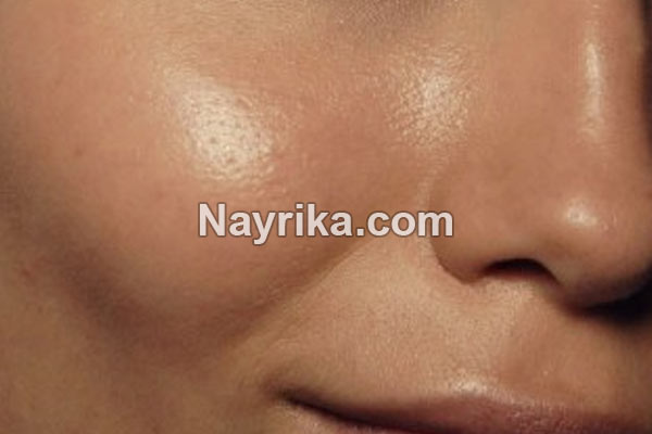 پوست چرب, پوست چرب چیست, ویژگی پوست چرب, فواید پوست چرب, صابون برای پوست چرب, ماسک پوست چرب, درمان پوست چرب و جوش دار, برنامه مراقبت از پوست چرب, پاکسازی پوست چرب در خانه پوست چرب, پوست چرب چیست, ویژگی پوست چرب, فواید پوست چرب, صابون برای پوست چرب, ماسک پوست چرب, درمان پوست چرب و جوش دار, برنامه مراقبت از پوست چرب, پاکسازی پوست چرب در خانه