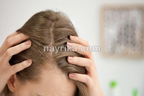 ریزش مو, جلوگیری از ریزش مو, مهمترین علت ریزش مو, علت ناگهانی ریزش مو, برای جلوگیری از ریزش مو چه بخوریم, جلوگیری از ریزش مو با روغن زیتون, علت ریزش مو در جوانان, شامپو برای جلوگیری از ریزش مو, درمان ریزش مو با آب پیاز, ریزش مو شدید, درمان خانگی ریزش مو و شوره سر, جلوگیری ریزش مو, ریزش مو شدید دارم, جلوگیری از ریزش موی سر ریزش مو, جلوگیری از ریزش مو, مهمترین علت ریزش مو, علت ناگهانی ریزش مو, برای جلوگیری از ریزش مو چه بخوریم, جلوگیری از ریزش مو با روغن زیتون, علت ریزش مو در جوانان, شامپو برای جلوگیری از ریزش مو, درمان ریزش مو با آب پیاز, ریزش مو شدید, درمان خانگی ریزش مو و شوره سر, جلوگیری ریزش مو, ریزش مو شدید دارم, جلوگیری از ریزش موی سر