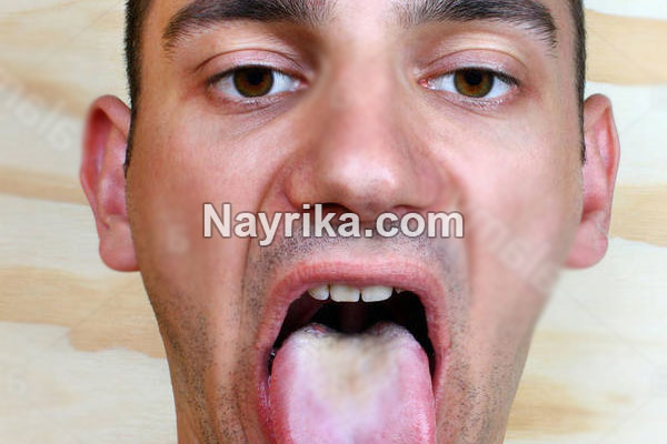 کم خونی, کم خونی چیست, انواع کم خونی, علائم ظاهری کم خونی, درمان کم خونی در طب سنتی, علائم سردرد کم خونی, کم خونی مینور, علائم کم خونی در کودکان, شایع ترین علائم کم خونی, علائم کم خونی در مردان, درمان کم خونی با عسل, درمان کم خونی با داروهای گیاهی, درمان کم خونی کودکان, درمان کم خونی در مردان, درمان کم خونی مینور, درمان کم خونی دکتر روازاده, درمان کم خونی تبریزیان کم خونی, کم خونی چیست, انواع کم خونی, علائم ظاهری کم خونی, درمان کم خونی در طب سنتی, علائم سردرد کم خونی, کم خونی مینور, علائم کم خونی در کودکان, شایع ترین علائم کم خونی, علائم کم خونی در مردان, درمان کم خونی با عسل, درمان کم خونی با داروهای گیاهی, درمان کم خونی کودکان, درمان کم خونی در مردان, درمان کم خونی مینور, درمان کم خونی دکتر روازاده, درمان کم خونی تبریزیان