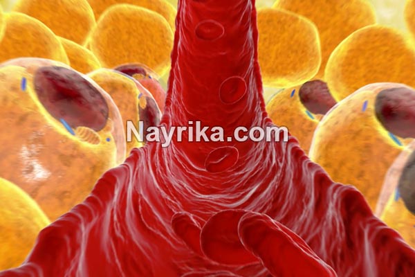 چربی خون, علائم چربی خون, علائم چربی خون عصبی, درمان خانگی چربی خون, درمان چربی خون در طب سنتی, چربی خون به انگلیسی, برای کاهش چربی خون چه بخوریم, بهترین دمنوش برای چربی خون, داروی چربی خون, درمان قطعی چربی خون, درمان چربی خون چربی خون, علائم چربی خون, علائم چربی خون عصبی, درمان خانگی چربی خون, درمان چربی خون در طب سنتی, چربی خون به انگلیسی, برای کاهش چربی خون چه بخوریم, بهترین دمنوش برای چربی خون, داروی چربی خون, درمان قطعی چربی خون, درمان چربی خون