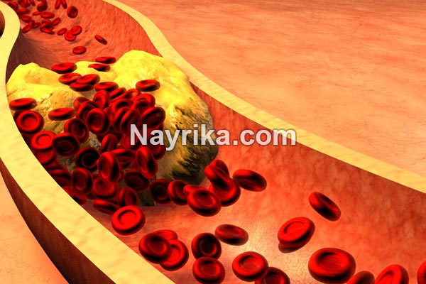 چربی خون, علائم چربی خون, علائم چربی خون عصبی, درمان خانگی چربی خون, درمان چربی خون در طب سنتی, چربی خون به انگلیسی, برای کاهش چربی خون چه بخوریم, بهترین دمنوش برای چربی خون, داروی چربی خون, درمان قطعی چربی خون, درمان چربی خون چربی خون, علائم چربی خون, علائم چربی خون عصبی, درمان خانگی چربی خون, درمان چربی خون در طب سنتی, چربی خون به انگلیسی, برای کاهش چربی خون چه بخوریم, بهترین دمنوش برای چربی خون, داروی چربی خون, درمان قطعی چربی خون, درمان چربی خون