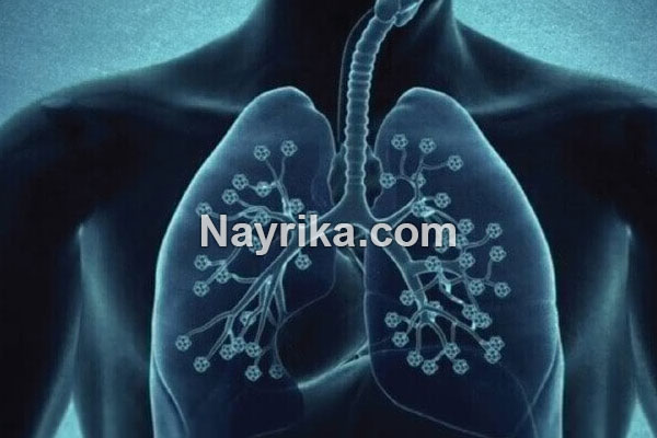 برونشیت, برونشیت چیست, علائم برونشیت, درمان قطعی برونشیت مزمن, برونشیت در کودکان, آیا برونشیت مسری است؟, برونشیت حاد چیست, برونشیت در نوزادان, آنتی بیوتیک برای برونشیت, درمان برونشیت در طب سنتی برونشیت, برونشیت چیست, علائم برونشیت, درمان قطعی برونشیت مزمن, برونشیت در کودکان, آیا برونشیت مسری است؟, برونشیت حاد چیست, برونشیت در نوزادان, آنتی بیوتیک برای برونشیت, درمان برونشیت در طب سنتی