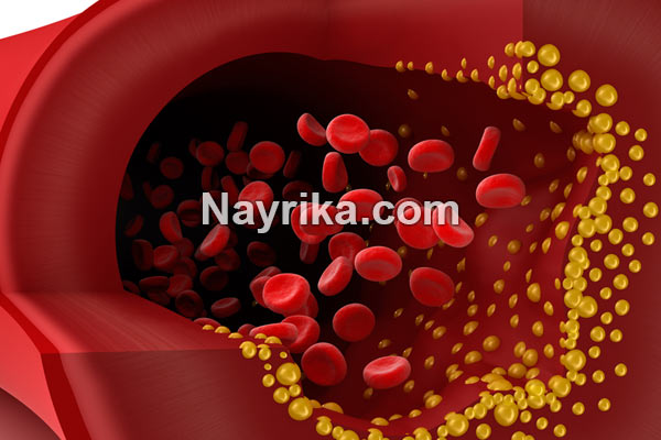 چربی خون, علائم چربی خون, علائم چربی خون عصبی, درمان خانگی چربی خون, درمان چربی خون در طب سنتی, چربی خون به انگلیسی, برای کاهش چربی خون چه بخوریم, بهترین دمنوش برای چربی خون, داروی چربی خون, درمان قطعی چربی خون, درمان چربی خون چربی خون, علائم چربی خون, علائم چربی خون عصبی, درمان خانگی چربی خون, درمان چربی خون در طب سنتی, چربی خون به انگلیسی, برای کاهش چربی خون چه بخوریم, بهترین دمنوش برای چربی خون, داروی چربی خون, درمان قطعی چربی خون, درمان چربی خون