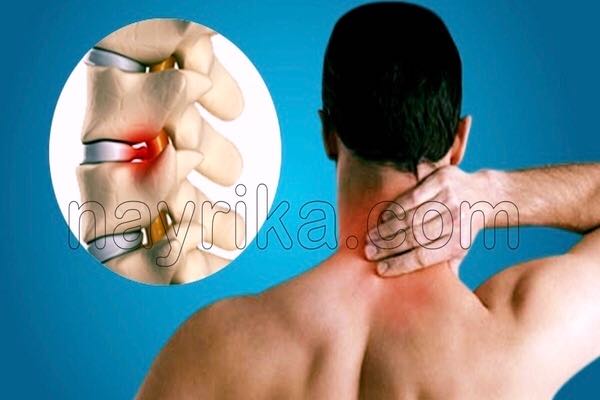 آرتروز, آرتروز چیست, علائم آرتروز, انواع آرتروز, آرتروز دست, آرتروز گردن, آرتروز زانو چیست, درمان آرتروز, درمان گیاهی آرتروز, برای درمان آرتروز چه باید کرد, قرص آرتروز زانو, درمان آرتروز دست, درمان آرتروز پا, درمان آرتروز گردن, درمان آرتروز کمر, برای درمان ارتروز چه بخوریم, درمان سنتی آرتروز, غذاهای ضد ارتروز آرتروز, آرتروز چیست, علائم آرتروز, انواع آرتروز, آرتروز دست, آرتروز گردن, آرتروز زانو چیست, درمان آرتروز, درمان گیاهی آرتروز, برای درمان آرتروز چه باید کرد, قرص آرتروز زانو, درمان آرتروز دست, درمان آرتروز پا, درمان آرتروز گردن, درمان آرتروز کمر, برای درمان ارتروز چه بخوریم, درمان سنتی آرتروز, غذاهای ضد ارتروز