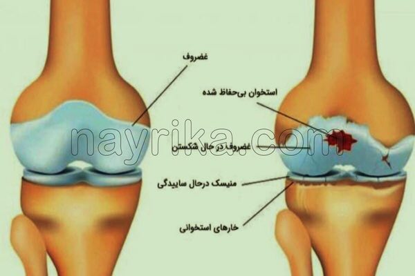 آرتروز, آرتروز چیست, علائم آرتروز, انواع آرتروز, آرتروز دست, آرتروز گردن, آرتروز زانو چیست, درمان آرتروز, درمان گیاهی آرتروز, برای درمان آرتروز چه باید کرد, قرص آرتروز زانو, درمان آرتروز دست, درمان آرتروز پا, درمان آرتروز گردن, درمان آرتروز کمر, برای درمان ارتروز چه بخوریم, درمان سنتی آرتروز, غذاهای ضد ارتروز آرتروز, آرتروز چیست, علائم آرتروز, انواع آرتروز, آرتروز دست, آرتروز گردن, آرتروز زانو چیست, درمان آرتروز, درمان گیاهی آرتروز, برای درمان آرتروز چه باید کرد, قرص آرتروز زانو, درمان آرتروز دست, درمان آرتروز پا, درمان آرتروز گردن, درمان آرتروز کمر, برای درمان ارتروز چه بخوریم, درمان سنتی آرتروز, غذاهای ضد ارتروز
