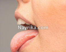 خشکی دهان و گلو: علت و درمان در طب سنتی / خشکی دهان و دیابت، صفرا، و کبد