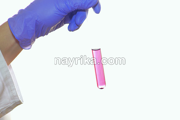 تالاسمی, تالاسمی چیست, انواع تالاسمی, علائم تالاسمی, درمان تالاسمی, تالاسمی آلفا+ازدواج, تالاسمی مینور ازدواج, تالاسمی مینور و بارداری, تالاسمی بتا, تالاسمی آلفا, علائم تالاسمی مینور در بزرگسالان, ازدواج تالاسمی آلفا و بتا, نشانه های ظاهری تالاسمی مینور, از کجا بفهمم تالاسمی دارم