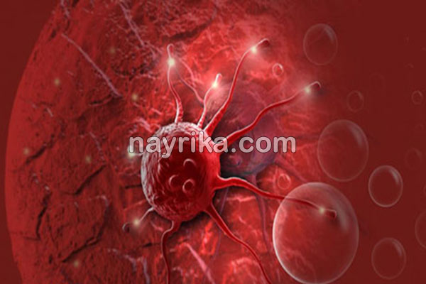 سرطان معده, سن سرطان معده, تشخیص سرطان معده, علائم اولیه سرطان معده, درمان سرطان معده, سرطان معده خوش خیم, طول عمر سرطان معده, درمان سرطان معده در طب سنتی, از کجا بفهمیم سرطان معده داریم, سرطان معده را چگونه تشخیص دهیم, علائم سرطان معده سرطان معده, سن سرطان معده, تشخیص سرطان معده, علائم اولیه سرطان معده, درمان سرطان معده, سرطان معده خوش خیم, طول عمر سرطان معده, درمان سرطان معده در طب سنتی, از کجا بفهمیم سرطان معده داریم, سرطان معده را چگونه تشخیص دهیم, علائم سرطان معده
