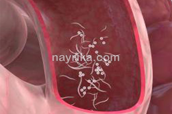کرمک, کرمک چیست, علائم کرمک, درمان کرمک مقعدی, درمان کرمک در طب سنتی, داروی ضد کرمک, داروی درمان کرمک در بزرگسالان, درمان خانگی کرمک در بزرگسالان, درمان کرمک مقعدی در کودکان, وجود کرم سفید در مدفوع بزرگسالان, معالجه کرمک, عکس کرمک کرمک, کرمک چیست, علائم کرمک, درمان کرمک مقعدی, درمان کرمک در طب سنتی, داروی ضد کرمک, داروی درمان کرمک در بزرگسالان, درمان خانگی کرمک در بزرگسالان, درمان کرمک مقعدی در کودکان, وجود کرم سفید در مدفوع بزرگسالان, معالجه کرمک