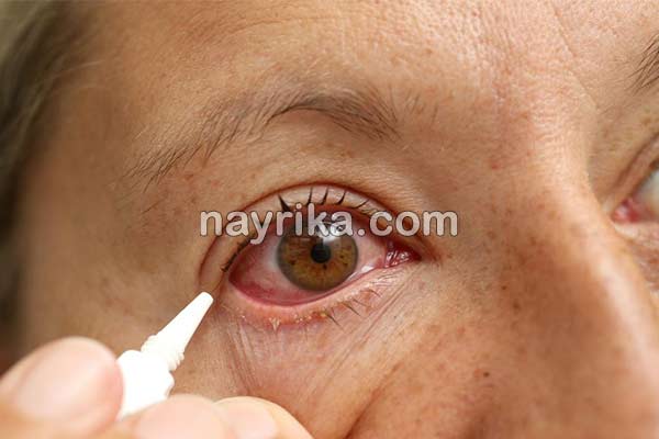 قرمزی چشم, علت قرمزی چشم, علت قرمزی چشم چپ, درمان قرمزی چشم, درمان قرمزی چشم در طب سنتی, قطره برای رفع قرمزی چشم, قرمزی زیر چشم نشانه چیست, درمان فوری قرمزی چشم, درمان سریع خونریزی چشم, رگه های قرمز در سفیدی چشم, اسم قطره برای قرمزی چشم قرمزی چشم, علت قرمزی چشم, علت قرمزی چشم چپ, درمان قرمزی چشم, درمان قرمزی چشم در طب سنتی, قطره برای رفع قرمزی چشم, قرمزی زیر چشم نشانه چیست, درمان فوری قرمزی چشم, درمان سریع خونریزی چشم, رگه های قرمز در سفیدی چشم, اسم قطره برای قرمزی چشم