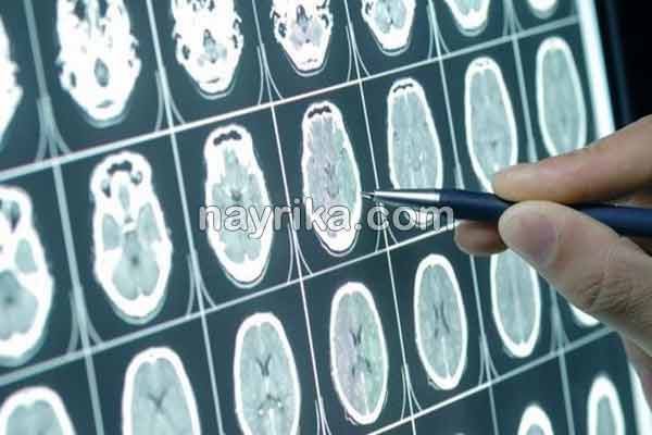 شیزوفرنی, شیزوفرنی چیست, علائم شیزوفرنی, درمان شیزوفرنی, درمان قطعی شیزوفرنی, درمان شیزوفرنی در طب سنتی, تفاوت شیزوفرنی و اسکیزوفرنی, شیزوفرنی خفیف, شیزوفرنی و ازدواج, تست تشخیص شیزوفرنی, شیزوفرنی چیست و درمان شیزوفرنی, شیزوفرنی چیست, علائم شیزوفرنی, درمان شیزوفرنی, درمان قطعی شیزوفرنی, درمان شیزوفرنی در طب سنتی, تفاوت شیزوفرنی و اسکیزوفرنی, شیزوفرنی خفیف, شیزوفرنی و ازدواج, تست تشخیص شیزوفرنی, شیزوفرنی چیست و درمان
