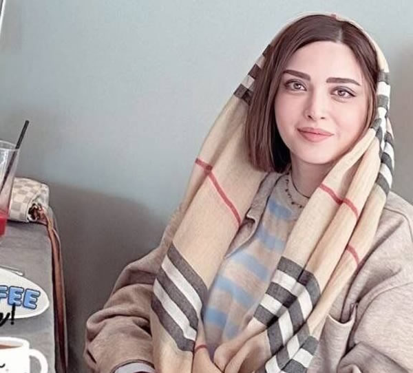 بهنوش طباطبایی بعد از عمل